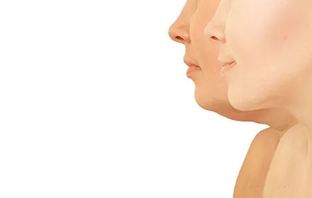 Profile of women's chins